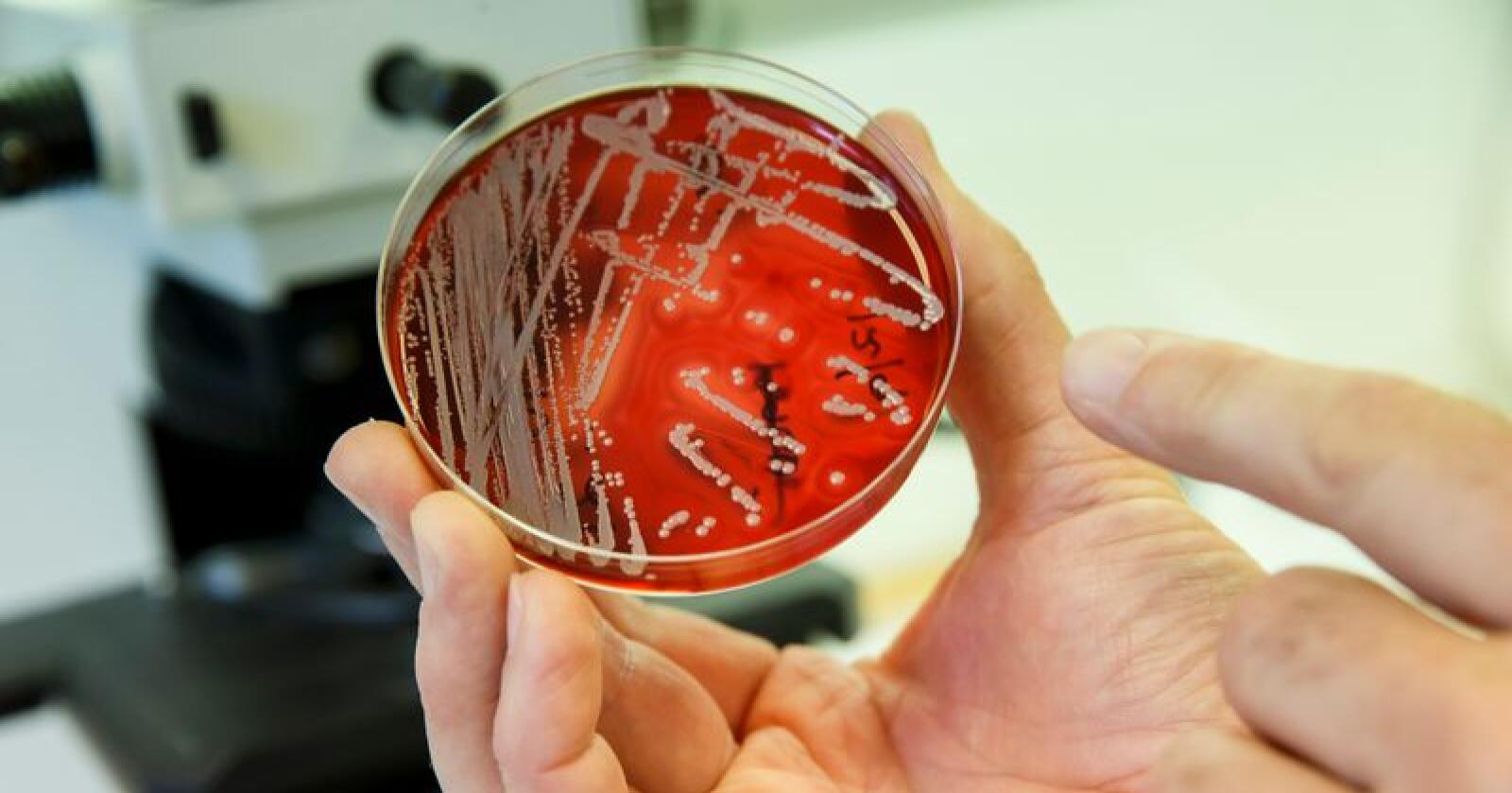Bakterier som er resistene mot antibiotika kan bli en stor trussel mot menneskeheten, tror britiske Dame Sally Davies. Foto: Cornelius Poppe / NTB scanpix