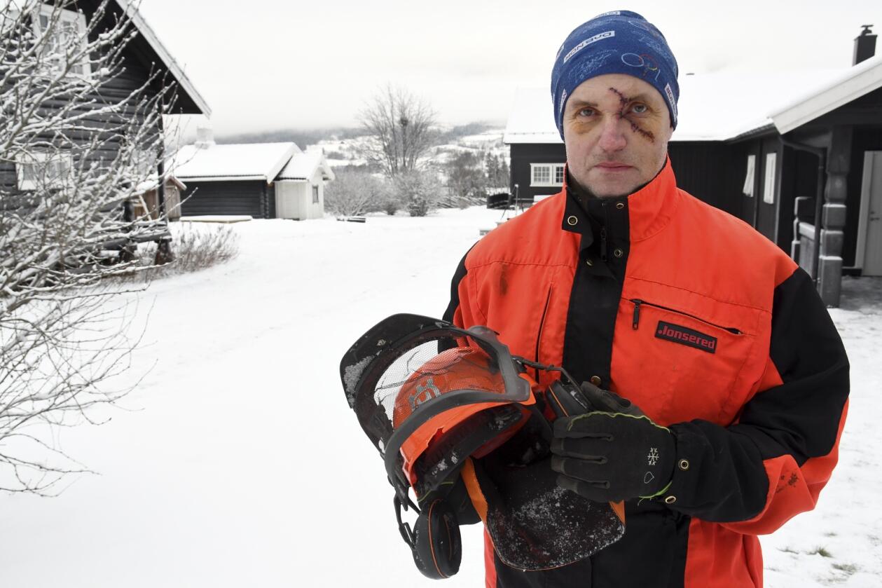 Jo Kjorstad fra Harpefoss i Innlandet skadet seg stygt i skogen i jula. Hjelmen er nå kassert, den tok heldigvis noe av for slaget av stokken. (Foto: Kristin Veskje, Gudbrandsdølen Dagningen)